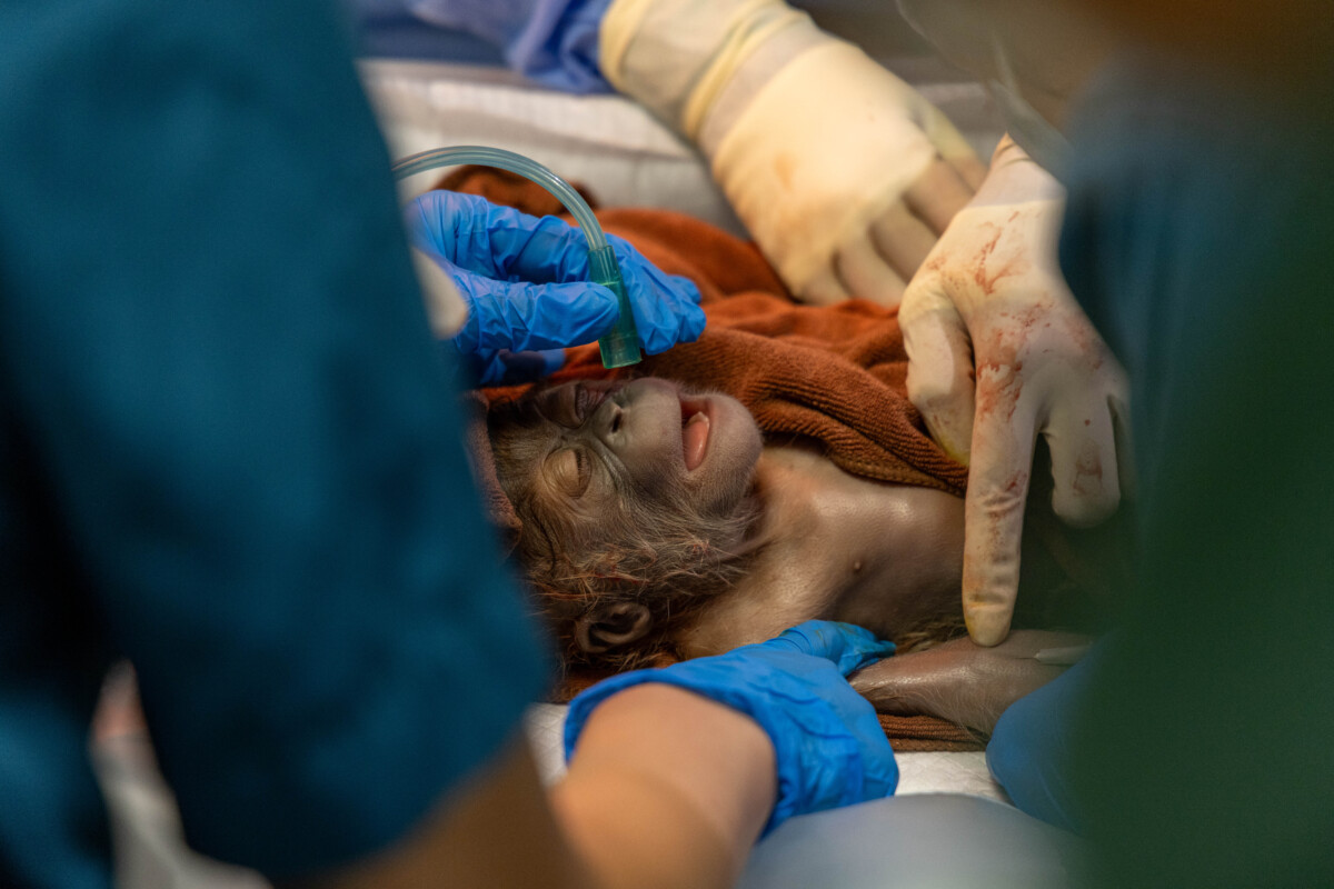 Ayaan, a male Sumatran orangutan, moments after his caesarean delivery on 18 March 2026 at Singapore Zoo. Photo credit: Mandai Wildlife Group